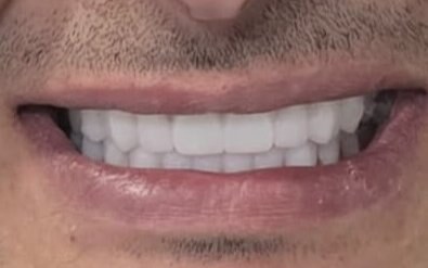 sonrası