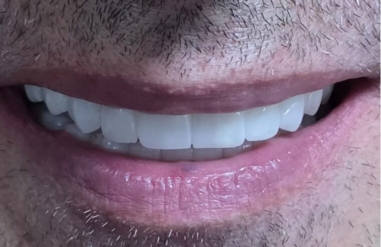sonrası